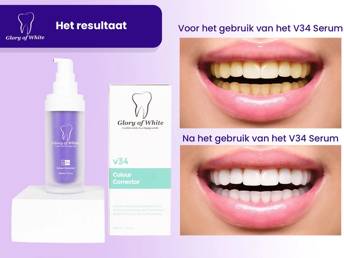 Glory Of White V34 Serum - Kleurcorrector - Witte Tanden - Tandpasta - Tanden Reinigen - Teeth Whitening - 30ML 10 Glory Of White V34 Serum - Kleurcorrector - Witte Tanden - Tandpasta - Tanden Reinigen - Teeth Whitening - 30ML - Afbeelding 8