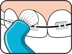 TePe Compact Tuft - Single Tufted Borstel - Tandenborstel -Verzorgingsproducten 1200x902 3