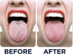 JuliBrite Tong Gel (50 ML) Tongreinigende Gel - Verfrist De Adem - Schone Tong -Verzorgingsproducten 1200x914 1