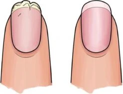 Herome 3 In 1 Manicure Nagelverzorging Set Blauw – Nagelset Voor Beschadigde Nagels - Nagelverharder, Nagellakremover En Nagelriemcreme - Set Van 3 15 Herome 3 In 1 Manicure Nagelverzorging Set Blauw – Nagelset Voor Beschadigde Nagels - Nagelverharder, Nagellakremover En Nagelriemcreme - Set Van 3 -Verzorgingsproducten 1200x920