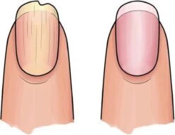 Herome 3 In 1 Manicure Nagelverzorging Set (Nail Essentials Geel) – Nagelset Voor Droge En Geribbelde Nagels – Base Coat, Vijl En Voedende Nagelolie – Voor Egale En Flexibele Nagels -Verzorgingsproducten 1200x926