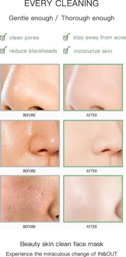 Merkloos Green Mask Stick - Huidverzorging - Gezichtsmasker - Kleimasker - Mee Eters & Acne Verwijderen - Acne Verzorging - Vette Huid - Mee-eter Verwijderaar - Poriën Reiniger -Blackhead - Verzachtend -Verkoelend - Dermatologisch Getest 15 Merkloos Green Mask Stick - Huidverzorging - Gezichtsmasker - Kleimasker - Mee Eters & Acne Verwijderen - Acne Verzorging - Vette Huid - Mee-eter Verwijderaar - Poriën Reiniger -Blackhead - Verzachtend -Verkoelend - Dermatologisch Getest -Verzorgingsproducten 592x1200 3