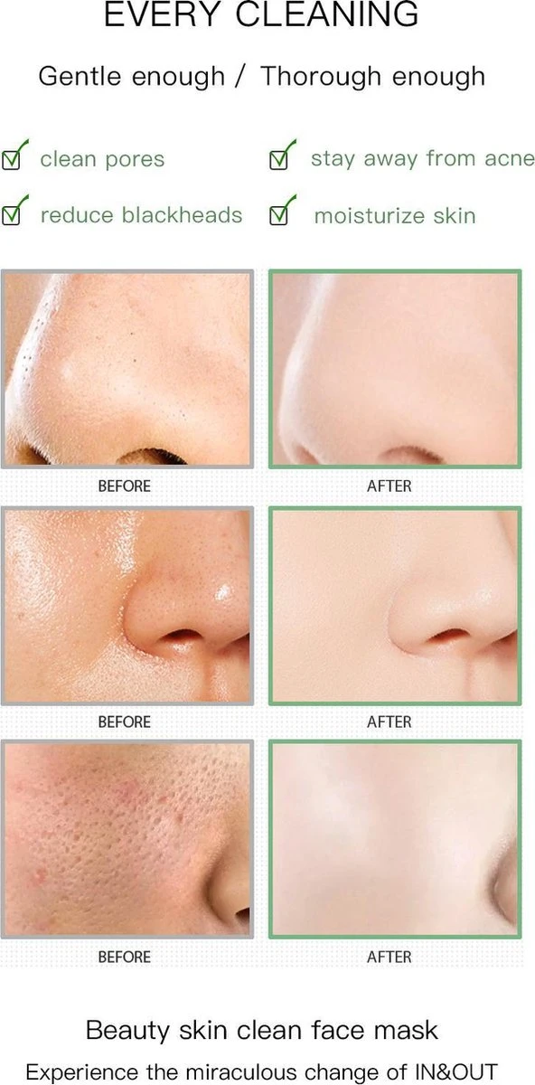 Merkloos Green Mask Stick - Huidverzorging - Gezichtsmasker - Kleimasker - Mee Eters & Acne Verwijderen - Acne Verzorging - Vette Huid - Mee-eter Verwijderaar - Poriën Reiniger -Blackhead - Verzachtend -Verkoelend - Dermatologisch Getest 5 Merkloos Green Mask Stick - Huidverzorging - Gezichtsmasker - Kleimasker - Mee Eters & Acne Verwijderen - Acne Verzorging - Vette Huid - Mee-eter Verwijderaar - Poriën Reiniger -Blackhead - Verzachtend -Verkoelend - Dermatologisch Getest - Afbeelding 3