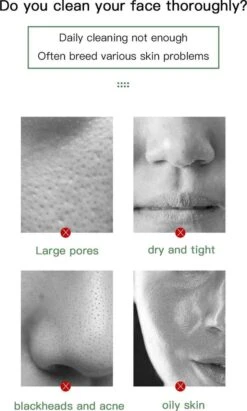 Merkloos Green Mask Stick - Huidverzorging - Gezichtsmasker - Kleimasker - Mee Eters & Acne Verwijderen - Acne Verzorging - Vette Huid - Mee-eter Verwijderaar - Poriën Reiniger -Blackhead - Verzachtend -Verkoelend - Dermatologisch Getest 16 Merkloos Green Mask Stick - Huidverzorging - Gezichtsmasker - Kleimasker - Mee Eters & Acne Verwijderen - Acne Verzorging - Vette Huid - Mee-eter Verwijderaar - Poriën Reiniger -Blackhead - Verzachtend -Verkoelend - Dermatologisch Getest -Verzorgingsproducten 721x1200 4