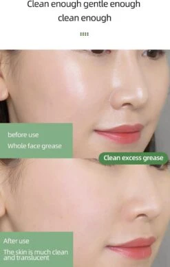 MENGSIQI - Green Mask Stick - Huidverzorging - Gezichtsmasker - Kleimasker - Mee Eters & Acne Verwijderen - Acne Verzorging - Vette Huid - Mee-eter Verwijderaar - Poriën Reiniger -Blackhead - Unisex - Verzachtend -Verkoelend - Dermatologisch Getest -Verzorgingsproducten 761x1200 2