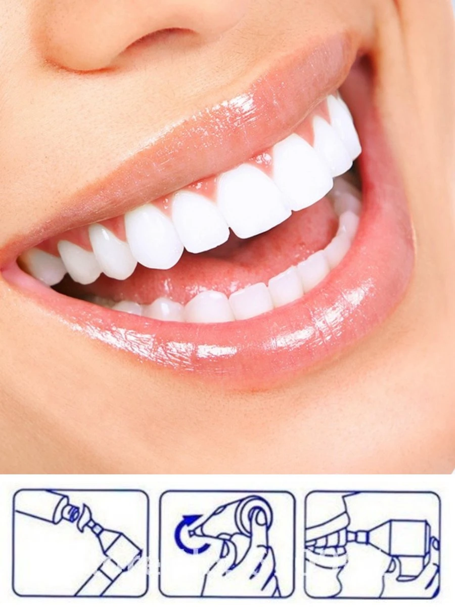 Merkloos HQ Tooth Polisher - Tanden Polijsten - Wittere Tanden - Tandsteen Tandplak Verwijderaar - Elektrisch 5 Merkloos HQ Tooth Polisher - Tanden Polijsten - Wittere Tanden - Tandsteen Tandplak Verwijderaar - Elektrisch - Afbeelding 3