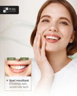 Tandenbleekset INCL. 14 Whitening Strips En 6 Gelpennen - ZONDER PEROXIDE - Teeth Whitening Kit - Tandenbleekset Met Ebook En Nederlandse Handleiding - Tandenblekers - Valentijnsdag Cadeau -Verzorgingsproducten 960x1200 36