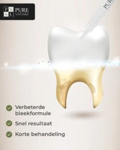 3x Navulling Tanden Bleekgel Spuiten ZONDER Peroxide - Refill Gel - Navulling - Veilig Tanden Bleken - Witte Tanden - Teeth Whitening - Valentijnsdag Cadeau -Verzorgingsproducten 960x1200 46